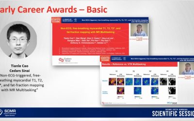 Society for Cardiovascular MR Early Career Award Given To Ph.D Student Tianle Cao