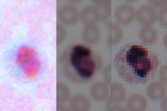 Deep learning transforms smartphone microscopes into laboratory-grade devices