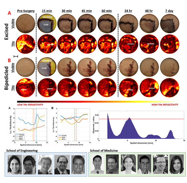 Multidisciplinary team publishes the first study of terahertz imaging based assessment of tissue flap viability